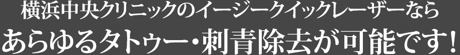 横浜中央クリニックのイージークイックレーザーならあらゆるタトゥー・刺青除去が可能です!
